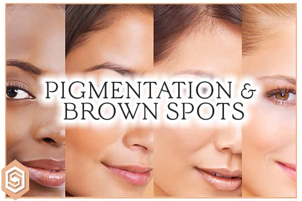 Hyperpigmentation/Brown Spots
