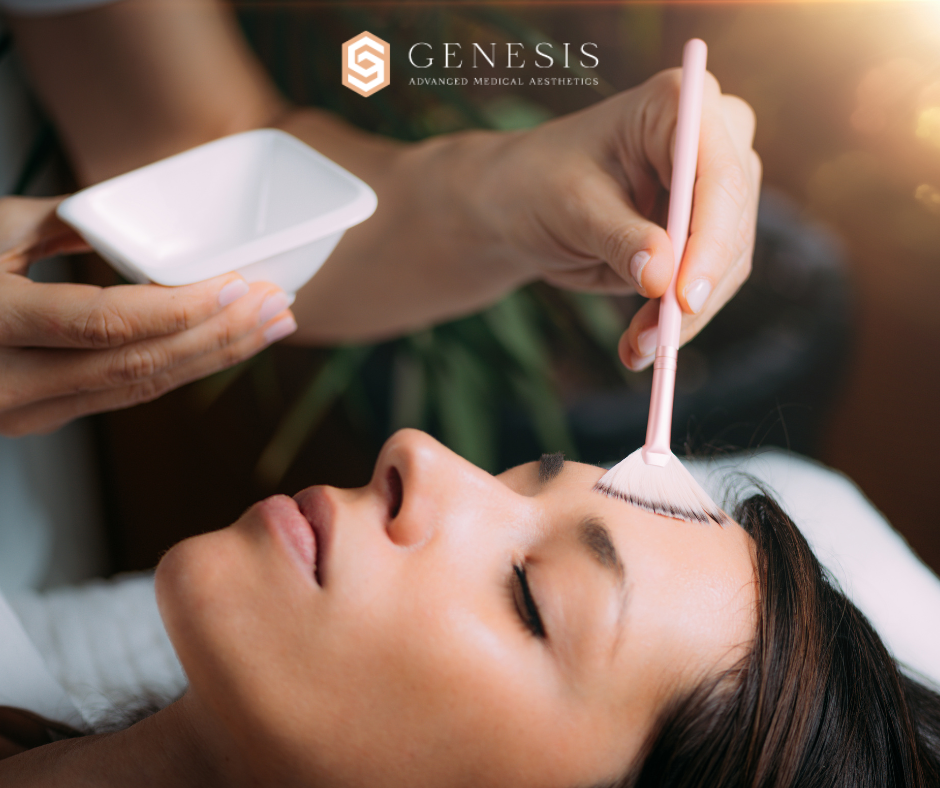 The Benefits of Chemical Peels | Genesis Advanced Medical Aesthetics