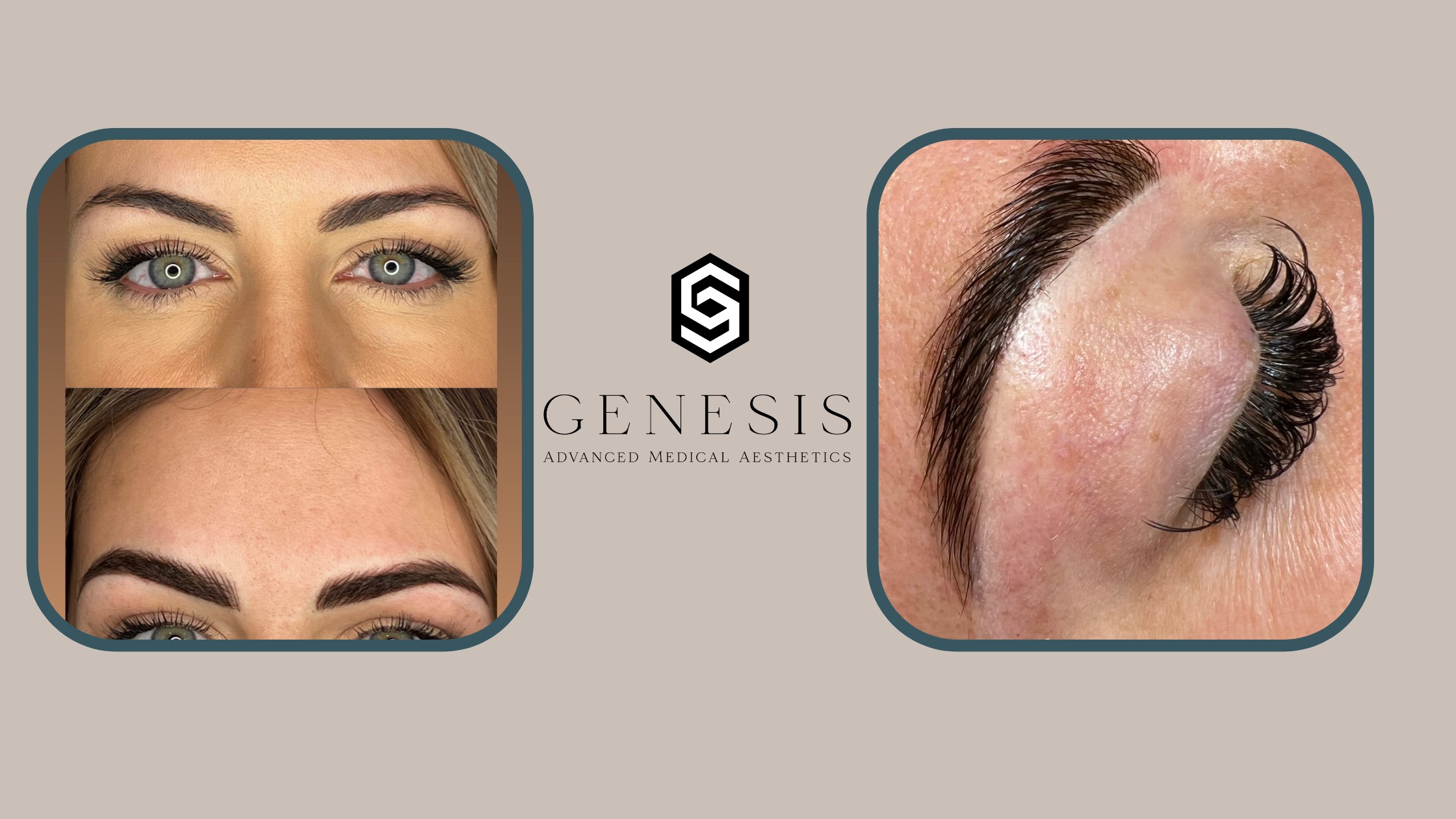 The Perfect Brows are Here: Meet Your New Brow Bestie, Emily! | Genesis Advanced Medical Aesthetics