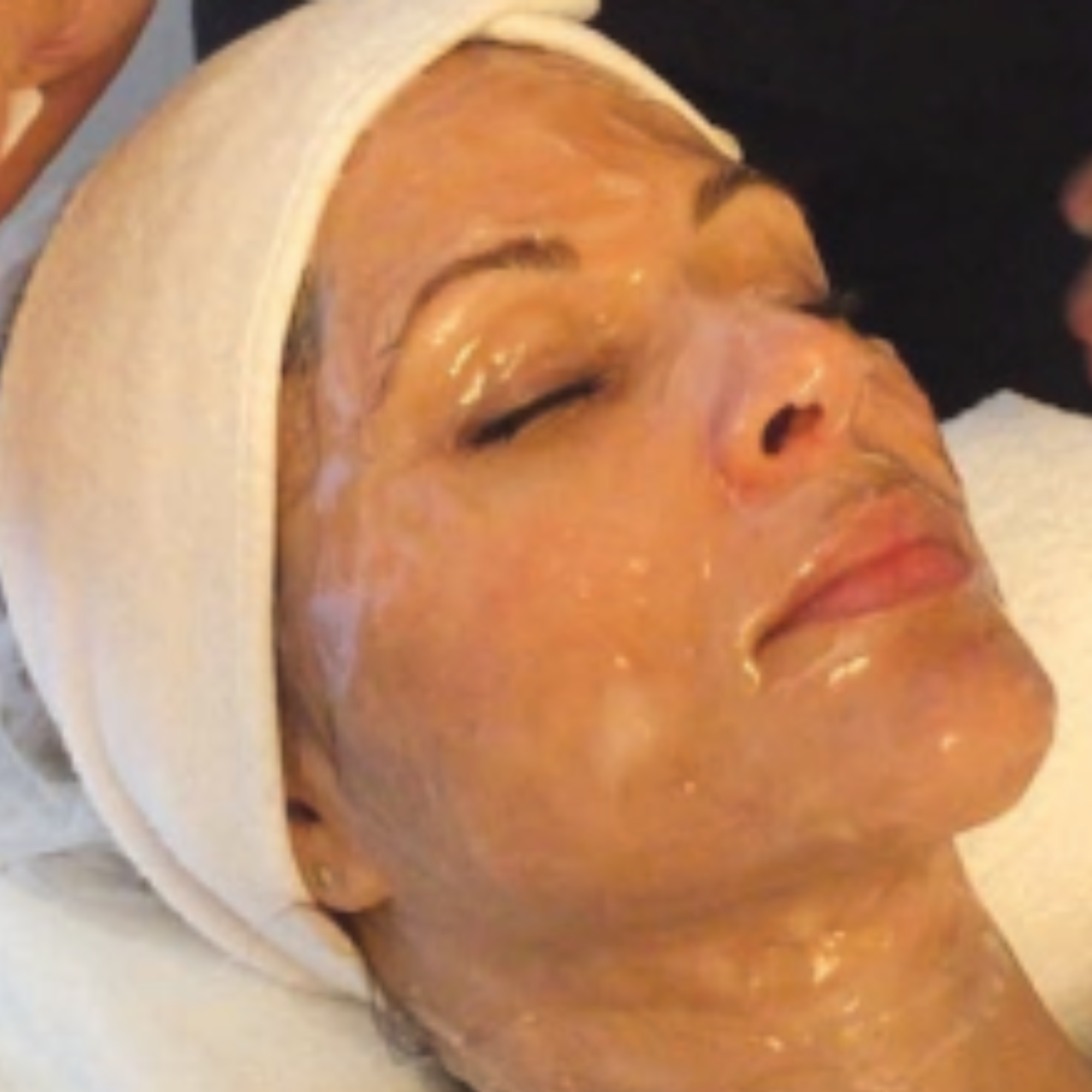 Is Hyperbaric Oxygen Therapy (HBOT) Worth the Hype in Aesthetics?